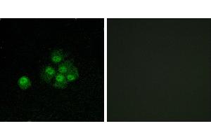 P-peptide - +Immunofluorescence analysis of MCF7 cells, using IRS-1 (Phospho-Ser636) antibody. (IRS1 anticorps  (pSer636))
