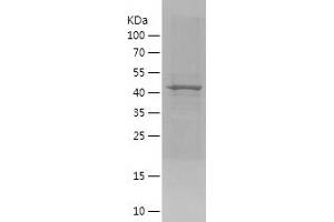 Western Blotting (WB) image for Single-Minded Homolog 2 (SIM2) (AA 350-550) protein (His-IF2DI Tag) (ABIN7125101)