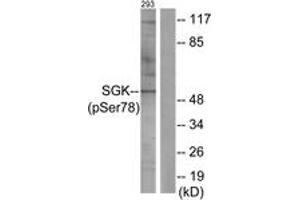 Western blot analysis of extracts from 293 cells treated with UV 15', using SGK (Phospho-Ser78) Antibody. (SGK1 anticorps  (pSer78))