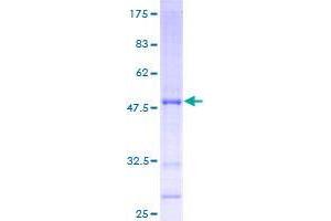 Image no. 1 for Androgen-Induced 1 (AIG1) (AA 1-238) protein (GST tag) (ABIN1344672)