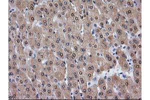 Image no. 3 for anti-Alcohol Dehydrogenase 1B (Class I), beta Polypeptide (ADH1B) antibody (ABIN1496479) (ADH1B anticorps)