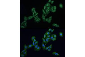 Immunofluorescence analysis of U2OS cells using AGTRAP Rabbit pAb (ABIN6130822, ABIN6136657, ABIN6136658 and ABIN6215773) at dilution of 1:100 (40x lens).