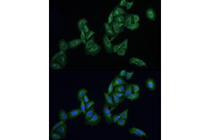 Immunofluorescence analysis of U2OS cells using AGTRAP Rabbit pAb (ABIN6130822, ABIN6136657, ABIN6136658 and ABIN6215773) at dilution of 1:100 (40x lens). (AGTRAP anticorps  (AA 93-152))