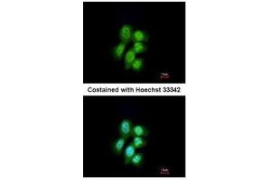 ICC/IF Image Immunofluorescence analysis of paraformaldehyde-fixed A431, using MVP/LRP, antibody at 1:200 dilution.