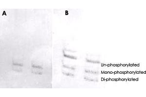 MYL6 (phospho S19/20) polyclonal antibody  was used at a 1 : 1000 dilution to detect myosin light chain by Western blot on NIH/3T3 cell lysates. (MYL6 anticorps  (pSer19, pSer20))