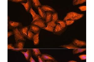 Immunofluorescence analysis of U2OS cells using BGLAP Polyclonal Antibody at dilution of 1:100. (Osteocalcin anticorps)