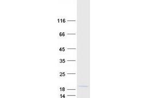 Validation with Western Blot