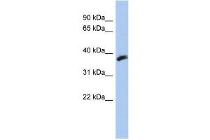 WB Suggested Anti-CYB5RL Antibody Titration: 0. (CYB5RL anticorps  (N-Term))