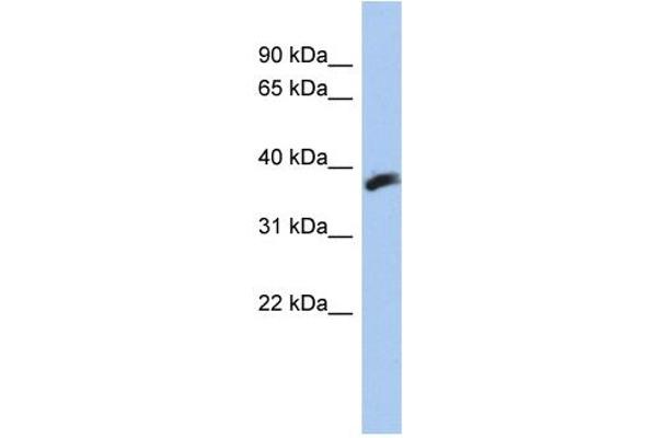 CYB5RL anticorps  (N-Term)