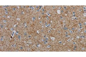 Immunohistochemistry of paraffin-embedded Human brain tissue using PGLYRP1 Polyclonal Antibody at dilution 1:40