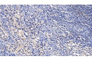 Detection of SOD1 in Human Spleen Tissue using Polyclonal Antibody to Superoxide Dismutase 1 (SOD1) (SOD1 anticorps  (AA 2-154))