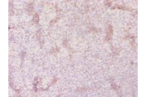 Immunohistochemistry of paraffin-embedded human tonsil tissue using ABIN7170251 at dilution of 1:20 (SLC41A2 anticorps  (AA 1-162))