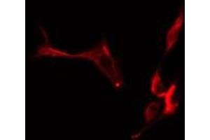 ABIN6276787 staining  HuvEc cells by IF/ICC. (CTNND1 anticorps)