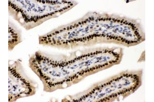 Anti- AMPK beta 2 Picoband antibody, IHC(P) IHC(P): Mouse Intestine Tissue
