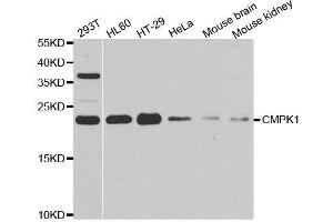 Western blot analysis of extracts of various cell lines, using CMPK1 antibody. (Cytidine Monophosphate (UMP-CMP) Kinase 1, Cytosolic (CMPK1) (AA 69-228) anticorps)