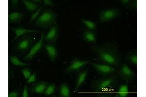 Image no. 2 for anti-Mitogen-Activated Protein Kinase-Activated Protein Kinase 2 (MAPKAPK2) (AA 302-401) antibody (ABIN598601) (MAPKAP Kinase 2 anticorps  (AA 302-401))