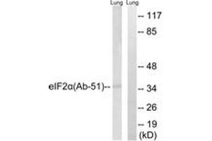 Western blot analysis of extracts from rat lung, using eIF2 alpha (Ab-51) Antibody. (EIF2A anticorps  (AA 21-70))