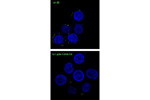 EphA1 was detected in live human breast adenocarcinoma MCF7 cells by confocal microscopy using Anti-EphA1 (extracellular) Antibody (ABIN7043132, 1:100), followed by goat anti-rabbit secondary antibody conjugated to Alexa Fluor® 488 (green).