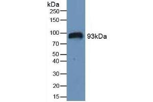 Detection of HIF1a in Human Serum using Polyclonal Antibody to Hypoxia Inducible Factor 1 Alpha (HIF1a) (HIF1A anticorps  (AA 575-826))