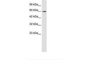 Image no. 2 for anti-Zinc Finger Protein 12 (ZNF12) (AA 73-122) antibody (ABIN202669) (ZNF12 anticorps  (AA 73-122))