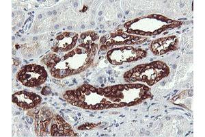 Immunohistochemical staining of paraffin-embedded Human Kidney tissue using anti-PFKP mouse monoclonal antibody. (PFKP anticorps)