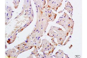 Formalin-fixed and paraffin embedded mouse heart tissue labeled with Anti-Desmin Polyclonal Antibody, Unconjugated  at 1:200, followed by conjugation to the secondary antibody and DAB staining