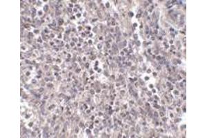 Immunohistochemistry of EBI3 in human spleen tissue with EBI3 antibody at 2.