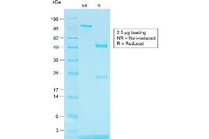 SDS-PAGE Analysis of Purified TYRP1 Rabbit Recombinant Monoclonal Antibody (TYRP1/1564R) (Tyrosinase-Related Protein 1 anticorps)