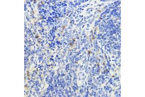 Immunohistochemistry of paraffin-embedded mouse spleen using IL10 antibody (ABIN3023111, ABIN3023112, ABIN3023113 and ABIN6219394) at dilution of 1:200 (40x lens). (IL-10 anticorps  (AA 19-178))