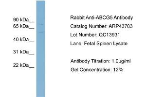 WB Suggested Anti-ABCG5 Antibody Titration:  0.