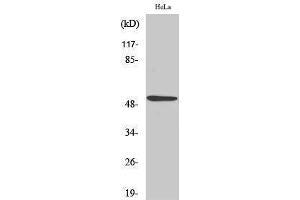 Western Blotting (WB) image for anti-Tumor Protein P53 (TP53) (Tyr210) antibody (ABIN3186285) (p53 anticorps  (Tyr210))