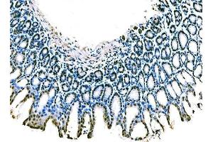 IHC analysis of KLF4 using anti-KLF4 antibody (ABIN7599343). (KLF4 anticorps  (AA 1-389))