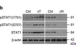 mTORC1 regulates CXCL9 in osteoblasts via STAT1. (STAT1 anticorps  (pTyr701))