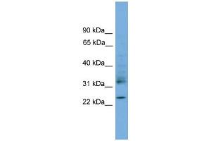 WB Suggested Anti-RHOJ Antibody Titration: 0. (RHOJ anticorps  (Middle Region))