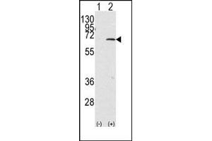 Image no. 1 for anti-Protein Inhibitor of Activated STAT, 1 (PIAS1) (C-Term) antibody (ABIN356763) (PIAS1 anticorps  (C-Term))