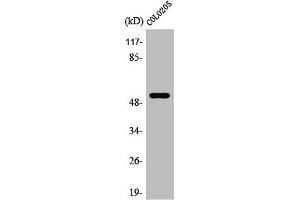 Western Blot analysis of Jurkat cells using PRP19 Polyclonal Antibody (PRP19 anticorps  (Internal Region))