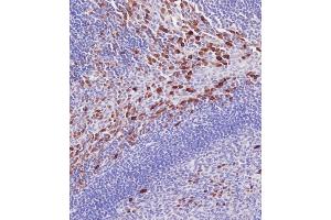Immunohistochemical analysis of A on paraffin-embedded Human tonsil tissue. (IRAK3 anticorps  (N-Term))