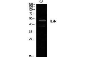 Western Blot (WB) analysis of KB cells using IL-7R Polyclonal Antibody. (IL7R anticorps  (Internal Region))