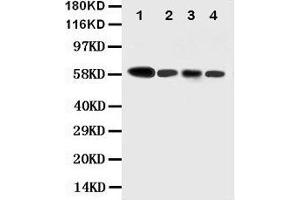 Anti-Caspase-10 antibody, Western blotting Lane 1: COLO320 Cell Lysate Lane 2: HELA Cell Lysate Lane 3: SW620 Cell Lysate Lane 4: RAJI Cell Lysate (Caspase 10 anticorps  (N-Term))