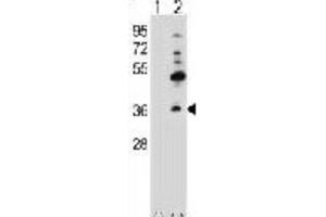 Western Blotting (WB) image for anti-Gap Junction Protein, beta 4, 30.3kDa (GJB4) antibody (ABIN2998429) (GJB4 anticorps)