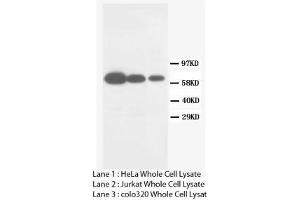 Image no. 2 for anti-Matrix Metallopeptidase 16 (Membrane-inserted) (MMP16) (C-Term) antibody (ABIN1493062)