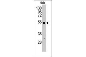 Western blot analysis of anti-BBS4 Pab in Hela cell line lysates (35ug/lane). (BBS4 anticorps  (Middle Region))