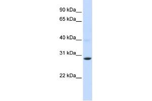 WB Suggested Anti-PGAM2 Antibody Titration:  0. (PGAM2 anticorps  (Middle Region))