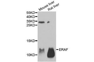 Western blot analysis of extracts of various tissues, using AHSP antibody. (aHSP anticorps)