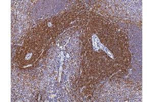 IHC analysis of Cd2 using anti-Cd2 antibody (ABIN7601386). (CD2 anticorps  (AA 34-330))