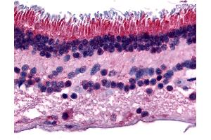Anti-PTPRM antibody IHC of human retina. (PTPRM anticorps  (Internal Region))
