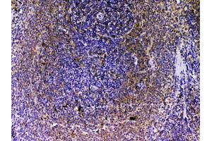 IHC analysis of VEGFB using anti-VEGFB antibody .