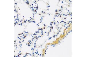 Immunohistochemistry of paraffin-embedded mouse lung using F antibody (ABIN3016158, ABIN3016159, ABIN3016160 and ABIN6219586) at dilution of 1:100 (40x lens).