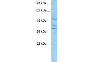 Host:  Mouse  Target Name:  RUVBL2  Sample Tissue:  Mouse Kidney  Antibody Dilution:  1ug/ml (RUVBL2 anticorps  (N-Term))