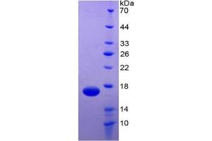SDS-PAGE of Protein Standard from the Kit  (Highly purified E.